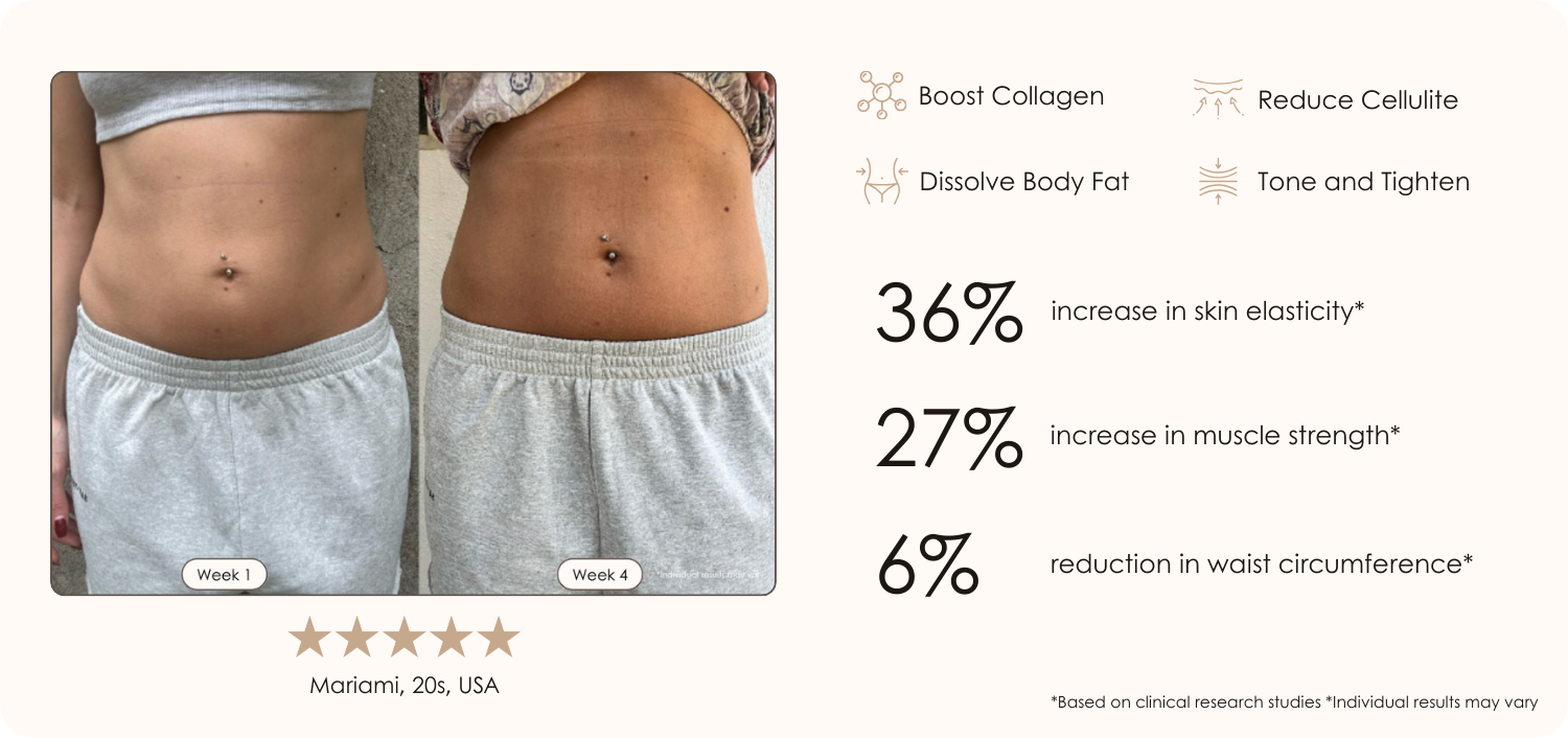 SERA Vacuum Body Contour  before and after results showing tighter slimmer abdomen